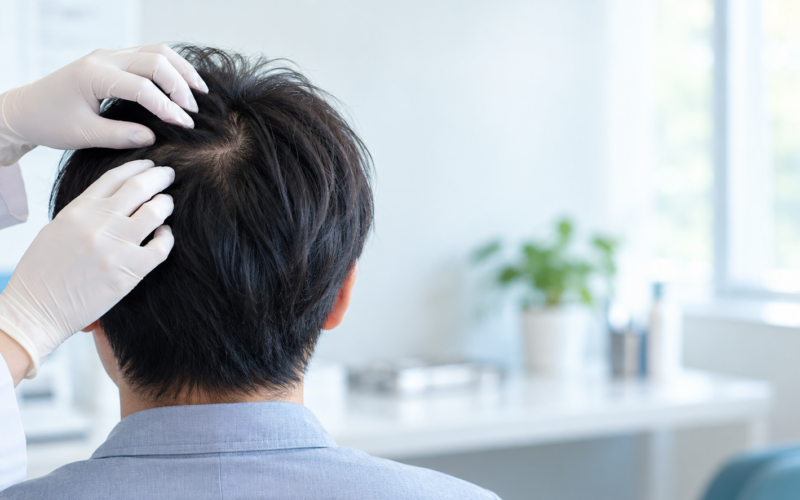 「エクソソームで髪は増えるのか」はどこまで確かめられているのか｜臨床研究11件の中身と、国内ガイドライン推奨度C2・法規制見直しの議論（2026年時点）